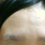 ★★★★★★사진有)<b>내손</b>으로 눈썹털뽑아버림ㅋㅋㅋㅋㅋㅋㅋㅋㅋㅋㅋㅋ★★★★★★★