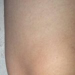 (사진有)다리 이렇게 <b>뼈</b>튀어나온건 어떻게해요ㅠㅠ?