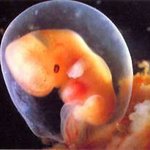 낙태 하지 마세요,태아도 소중한 생명입니다.