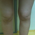 ★★(사진有)제 다리좀봐주세요ㅜㅠㅠㅠ★★
