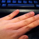 <b>손톱</b>물어뜯는버릇, 고치고 싶습니다.