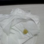 사진有)  혐오주의하세요.. <b>목구멍</b>에서뭐가나오는데 이거저만그런건가요...