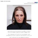 ☆★약간혐오有)세계에서 가장 희귀한 <b>질병</b>들☆★