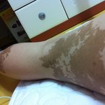 ★커다란 점이 <b>컴플렉스</b>인 언니들 드러와^-^★