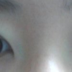 나 오늘 쌍수 완전절개햇는데 <b>속</b><b>쌍</b>될꺼같아??