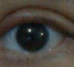 ★★★★사진有레이즈미업)쌍수후기ㅌ약속지켜요★★★★혐오주의!!!