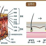 스트레스..결국 탈모로...ㅠㅠ <b>한방</b>탈모치료 신사동 정지행 한의원...