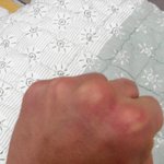 혐오????