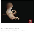 펌]아무나 사람을 <b>도아</b>주면 안되겠네요