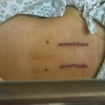 ▶▶■사진((有) 동생이 버스에 치였어요. 아픈데 응원해주세요