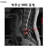 읽어주세요] 박원순 시장의 아들은 군대를 안가려 <b>mri</b>를 바꿔치기했다☆★