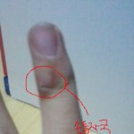 ★★★사진有) 일찐한테 손가락꺾여서 손가락이 휘었어요★★★