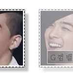 <b>g</b>껌뱉는빂님 부상