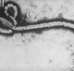 ◇◆◇◆공포의바이러스 - 에볼라바이러스◇◆◇◆