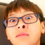 ★치과갔다와서 동생의 코가 ㅋㅋㅋ (사진+글)★