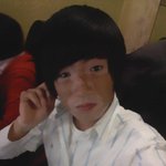 저는 불치병을 앓고있습니다....(백반증)