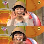 아이유성형 이것도아님???