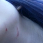친언니가 <b>도가</b> 지나친 폭력을 일삼습니다(사진 有)