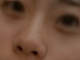 사진有! 콧볼보톡스맞아본분?