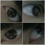 ★★혐오주의)이거<b>눈병</b>이에요?ㅠㅠ..심각★★