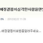 비스트<b>개호</b>9야내가지식인한테애정결핍치료법알려달라말햇음