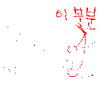 ★★★★박봄다리<b>운동</b>의 고통?★★★★