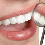 메디안 <b>치석</b>케어64%에서 소비자실험단을 모집하네요~