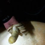 -19금-사진必 혐오,노약자,임산부 조심 제거기가...색깔과 <b>형태</b>가...