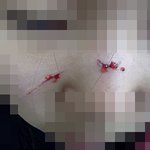 ☆★☆★☆★☆(사진有느님)지나가다가 <b>봉변</b>당한 내 베프 ㅡㅡ☆★☆★☆★☆
