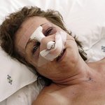 [성형이야기] <b>양악</b>수술 안하면 연예인이 아닌가?