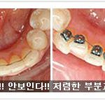 뭐이런광고가 !!!!
