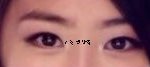 ★성형안하고 일주일<b>투자</b>해서 앞트임하기★