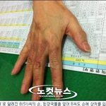 어린이한테 <b>국물</b>쏟고도망간 아주머니.. 마녀사냥..