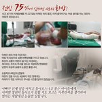 <얼굴조차 알아보기 어려운 <b>전신</b> 4도 화상 도와주세요>