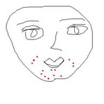 잘못 썼다가 개학 하루 전에 <b>접촉성</b> 피부염!!!!!!!(사진x,...