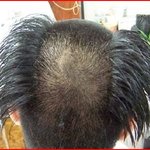 ★★★★★★★★★★친구가 짜피 <b>삭발</b>할꺼라며 머리를웃기게잘랏어요★★★★★★★
