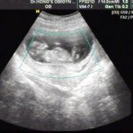 ★★문<b>메이슨</b> 성장과정 (대박주의)ㅋㅋㅋㅋㅋㅋ★★