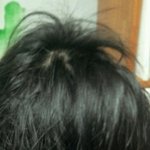 사진有) <b>정수리</b> 머리카락이........................