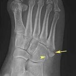 의료보험 눈가림에_ 결국 피해자는 대다수 국민입니다.