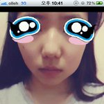 (사진有) 사랑니의 <b>위엄</b>