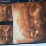 **사진有♥♥철없는 이모는 <b>혁이</b>가 좋아요♥♥