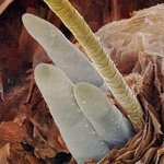 ☆★☆ 사람의 몸에 기생하는 벌레들(혐오주의) ☆★☆