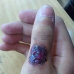 ★★★★시간을거스르는자!!옛날 유행: 상처그리기 <b>뒷북</b> ★★★★