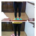 <b>박봄</b>다리전후!!사진비교확실해요★★★★★★★