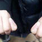 ★★원본★★ [혐오有사진有]내 친구 손가락이 돌아가버렸어요