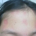 (사진有) 제 동생 <b>이마</b>가 이상합니다