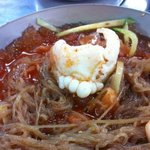 ★★★★<b>냉면</b>먹다 잇몸나옴!(사진有)★★★★