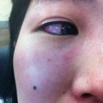 ●친구들한테 집단<b>폭행</b>당했어요 읽어주세요●