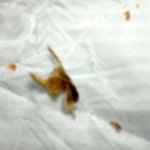 [19] ★★귀에서 <b>벌레</b>나옴★★[혐오]