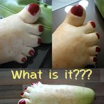 <b>돌연변이</b>의 대표적인 예